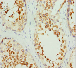 RCN2 Antibody - Immunohistochemistry of paraffin-embedded human testis tissue at dilution 1:100