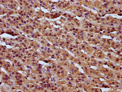 RCN3 Antibody - Immunohistochemistry Dilution at 1:200 and staining in paraffin-embedded human adrenal gland tissue performed on a Leica BondTM system. After dewaxing and hydration, antigen retrieval was mediated by high pressure in a citrate buffer (pH 6.0). Section was blocked with 10% normal Goat serum 30min at RT. Then primary antibody (1% BSA) was incubated at 4°C overnight. The primary is detected by a biotinylated Secondary antibody and visualized using an HRP conjugated SP system.