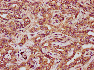 RCN3 Antibody - Immunohistochemistry Dilution at 1:200 and staining in paraffin-embedded human liver tissue performed on a Leica BondTM system. After dewaxing and hydration, antigen retrieval was mediated by high pressure in a citrate buffer (pH 6.0). Section was blocked with 10% normal Goat serum 30min at RT. Then primary antibody (1% BSA) was incubated at 4°C overnight. The primary is detected by a biotinylated Secondary antibody and visualized using an HRP conjugated SP system.