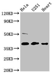 RCN3 Antibody - Western Blot Positive WB detected in: Hela whole cell lysate, U251 whole cell lysate, Mouse heart tissue All lanes: RCN3 antibody at 4.6µg/ml Secondary Goat polyclonal to rabbit IgG at 1/50000 dilution Predicted band size: 38 kDa Observed band size: 38 kDa