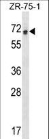 RCOR1 / COREST Antibody - RCOR1 Antibody western blot of ZR-75-1 cell line lysates (35 ug/lane). The RCOR1 antibody detected the RCOR1 protein (arrow).