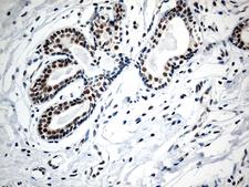 RCOR1 / COREST Antibody - Immunohistochemical staining of paraffin-embedded Human breast tissue within the normal limits using anti-RCOR1 mouse monoclonal antibody. (Heat-induced epitope retrieval by 1mM EDTA in 10mM Tris buffer. (pH8.5) at 120°C for 3 min. (1:500)