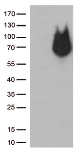 RCOR1 / COREST Antibody - HEK293T cells were transfected with the pCMV6-ENTRY control. (Left lane) or pCMV6-ENTRY RCOR1. (Right lane) cDNA for 48 hrs and lysed. Equivalent amounts of cell lysates. (5 ug per lane) were separated by SDS-PAGE and immunoblotted with anti-RCOR1. (1:500)