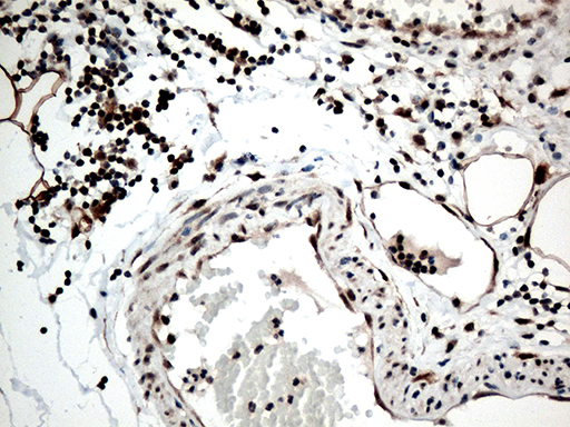 RCOR1 / COREST Antibody - Immunohistochemical staining of paraffin-embedded Human appendix tissue within the normal limits using anti-RCOR1 mouse monoclonal antibody. (Heat-induced epitope retrieval by 1mM EDTA in 10mM Tris buffer. (pH8.5) at 120°C for 3 min. (1:500)