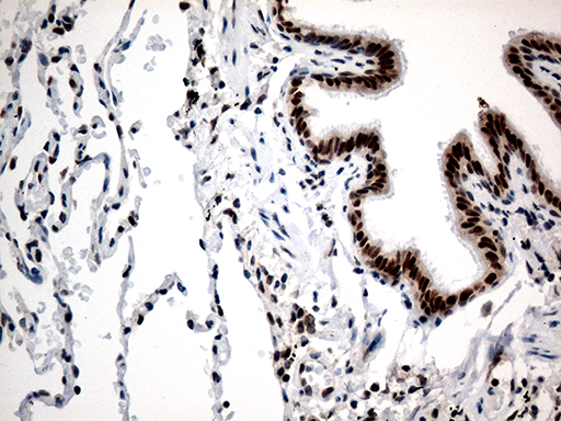 RCOR1 / COREST Antibody - Immunohistochemical staining of paraffin-embedded Human lung tissue within the normal limits using anti-RCOR1 mouse monoclonal antibody. (Heat-induced epitope retrieval by 1mM EDTA in 10mM Tris buffer. (pH8.5) at 120°C for 3 min. (1:500)