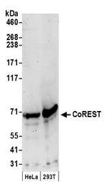 RCOR1 / COREST Antibody - Detection of human CoREST by western blot. Samples: Whole cell lysate (50 µg) from HeLa and HEK293T cells prepared using NETN lysis buffer. Antibody: Affinity purified rabbit anti-CoREST antibody used for WB at 0.66 µg/ml. Detection: Chemiluminescence with an exposure time of 3 minutes.