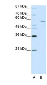 RCOR1 / COREST Antibody - RCOR1 / COREST antibody Western blot of Jurkat lysate. This image was taken for the unconjugated form of this product. Other forms have not been tested.