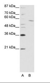RCOR1 / COREST Antibody - Jurkat Cell Lysate.  This image was taken for the unconjugated form of this product. Other forms have not been tested.