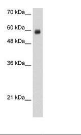 RCOR1 / COREST Antibody - Jurkat Cell Lysate.  This image was taken for the unconjugated form of this product. Other forms have not been tested.