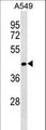RCOR2 Antibody - RCOR2 Antibody western blot of A549 cell line lysates (35 ug/lane). The RCOR2 antibody detected the RCOR2 protein (arrow).