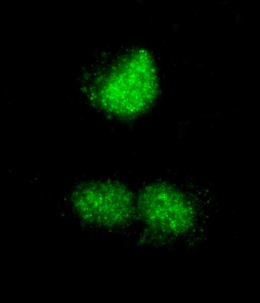 RCOR3 Antibody - Detection of Human RCOR3 by Immunocytochemistry. Sample: FFPE section of NBF-fixed HeLa Cells Antibody: Affinity purified rabbit anti-RCOR3 used at a dilution of 1:80 (2.5 ug/ml). Detection: Green-fluorescent Goat anti-Rabbit IgG-heavy and light chain cross-adsorbed Antibody DyLight 488 Conjugated (A120-601D2) used at a dilution of 1:100.