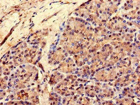 RCOR3 Antibody - Immunohistochemistry of paraffin-embedded human pancreatic tissue using RCOR3 Antibody at dilution of 1:100