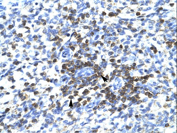 RCOR3 Antibody - RCOR3 antibody ARP34132_T100-NP_060724-RCOR3 (REST corepressor 3) Antibody was used in IHC to stain formalin-fixed, paraffin-embedded human spleen.  This image was taken for the unconjugated form of this product. Other forms have not been tested.