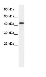 RCOR3 Antibody - Jurkat Cell Lysate.  This image was taken for the unconjugated form of this product. Other forms have not been tested.
