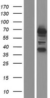 RCOR3 Protein - Western validation with an anti-DDK antibody * L: Control HEK293 lysate R: Over-expression lysate