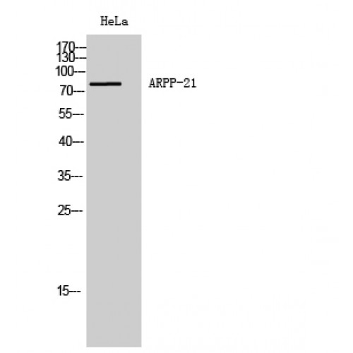 RCS / ARPP-21 Antibody - Western blot of ARPP-21 antibody