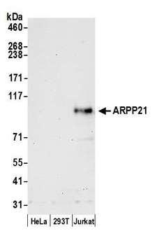 RCS / ARPP-21 Antibody - Detection of human ARPP21 by western blot. Samples: Whole cell lysate (50 µg) from HeLa, HEK293T, and Jurkat cells prepared using NETN lysis buffer. Antibody: Affinity purified rabbit anti-ARPP21 antibody used for WB at 1:1000. Detection: Chemiluminescence with an exposure time of 30 seconds.