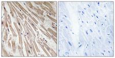 RCS / ARPP-21 Antibody - Immunohistochemistry analysis of paraffin-embedded human heart tissue, using ARPP21 Antibody. The picture on the right is blocked with the synthesized peptide.