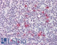 RCS / ARPP-21 Antibody - Anti-RCS / ARPP-21 antibody IHC of human thymus. Immunohistochemistry of formalin-fixed, paraffin-embedded tissue after heat-induced antigen retrieval. Antibody dilution 5-10 ug/ml. This image was taken for the unconjugated form of this product. Other forms have not been tested.