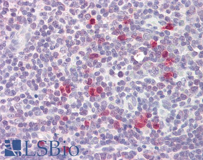 RCS / ARPP-21 Antibody - Anti-RCS / ARPP-21 antibody IHC of human thymus. Immunohistochemistry of formalin-fixed, paraffin-embedded tissue after heat-induced antigen retrieval. Antibody dilution 5-10 ug/ml. This image was taken for the unconjugated form of this product. Other forms have not been tested.
