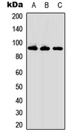 RCS / ARPP-21 Antibody - Western blot analysis of ARPP21 expression in HL60 (A); mouse kidney (B); mouse lung (C) whole cell lysates.