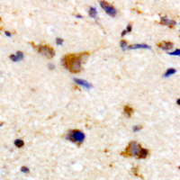 RCS / ARPP-21 Antibody - Immunohistochemical analysis of ARPP21 staining in human brain formalin fixed paraffin embedded tissue section. The section was pre-treated using heat mediated antigen retrieval with sodium citrate buffer (pH 6.0). The section was then incubated with the antibody at room temperature and detected using an HRP conjugated compact polymer system. DAB was used as the chromogen. The section was then counterstained with hematoxylin and mounted with DPX.