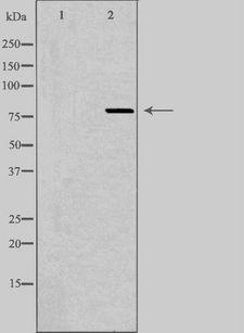 RCS / ARPP-21 Antibody - Western blot analysis of extracts of HeLa cells using ARPP21 antibody. The lane on the left is treated with the antigen-specific peptide.