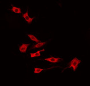 RCS / ARPP-21 Antibody - Staining HeLa cells by IF/ICC. The samples were fixed with PFA and permeabilized in 0.1% Triton X-100, then blocked in 10% serum for 45 min at 25°C. The primary antibody was diluted at 1:200 and incubated with the sample for 1 hour at 37°C. An Alexa Fluor 594 conjugated goat anti-rabbit IgG (H+L) Ab, diluted at 1/600, was used as the secondary antibody.