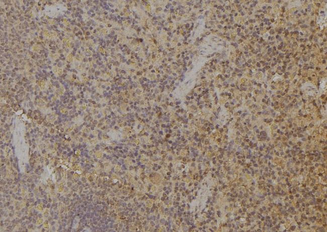 RCS / ARPP-21 Antibody - 1:100 staining rat spleen tissue by IHC-P. The sample was formaldehyde fixed and a heat mediated antigen retrieval step in citrate buffer was performed. The sample was then blocked and incubated with the antibody for 1.5 hours at 22°C. An HRP conjugated goat anti-rabbit antibody was used as the secondary.