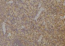 RCS / ARPP-21 Antibody - 1:100 staining rat spleen tissue by IHC-P. The sample was formaldehyde fixed and a heat mediated antigen retrieval step in citrate buffer was performed. The sample was then blocked and incubated with the antibody for 1.5 hours at 22°C. An HRP conjugated goat anti-rabbit antibody was used as the secondary.