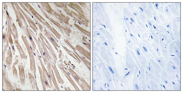 RCS / ARPP-21 Antibody - Peptide - + Immunohistochemistry analysis of paraffin-embedded human heart tissue, using ARPP21 antibody.