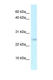 RCS / ARPP-21 Antibody - ARPP21 / ARPP-21 antibody Western blot of Mouse Thymus lysate. Antibody concentration 1 ug/ml.  This image was taken for the unconjugated form of this product. Other forms have not been tested.