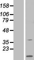 RCS / ARPP-21 Protein - Western validation with an anti-DDK antibody * L: Control HEK293 lysate R: Over-expression lysate