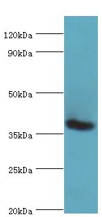 RD / PHYH Antibody - Western blot. All lanes: Phytanoyl-CoA dioxygenase, peroxisomal antibody at 3 ug/ml+mouse liver tissue. Secondary antibody: Goat polyclonal to rabbit at 1:10000 dilution. Predicted band size: 39 kDa. Observed band size: 39 kDa.