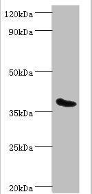 RD / PHYH Antibody - Western blot All lanes: Phytanoyl-CoA dioxygenase, peroxisomal antibody at 3µg/ml + Mouse liver tissue Secondary Goat polyclonal to rabbit IgG at 1/10000 dilution Predicted band size: 39, 28 kDa Observed band size: 39 kDa