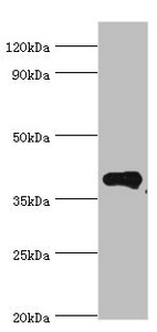 RD / PHYH Antibody - Western blot All lanes: Phytanoyl-CoA dioxygenase, peroxisomal antibody at 4µg/ml + Mouse liver tissue Secondary Goat polyclonal to rabbit IgG at 1/10000 dilution Predicted band size: 39, 28 kDa Observed band size: 39 kDa