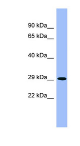 RD / PHYH Antibody - PHYH antibody Western blot of Fetal Brain lysate. This image was taken for the unconjugated form of this product. Other forms have not been tested.