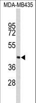 RD / PHYH Antibody - Western blot of PHYH Antibody in MDA-MB435 cell line lysates (35 ug/lane). PHYH (arrow) was detected using the purified antibody.