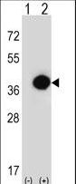 RD / PHYH Antibody - Western blot of PHYH (arrow) using rabbit polyclonal PHYH Antibody. 293 cell lysates (2 ug/lane) either nontransfected (Lane 1) or transiently transfected (Lane 2) with the PHYH gene.