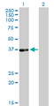 RD / PHYH Antibody - Western Blot analysis of PHYH expression in transfected 293T cell line by PHYH monoclonal antibody (M01), clone 1F2-5B9.Lane 1: PHYH transfected lysate(38.5 KDa).Lane 2: Non-transfected lysate.
