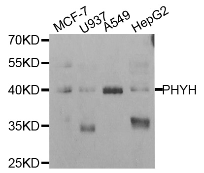 RD / PHYH Antibody - Western blot analysis of extracts of various cell lines.