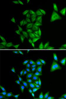 RD / PHYH Antibody - Immunofluorescence analysis of U2OS cells.