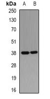 RD / PHYH Antibody - Western blot analysis of PHYH expression in MCF7 (A); HepG2 (B) whole cell lysates.