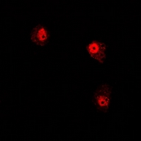 RD / PHYH Antibody - Immunofluorescent analysis of PHYH staining in U2OS cells. Formalin-fixed cells were permeabilized with 0.1% Triton X-100 in TBS for 5-10 minutes and blocked with 3% BSA-PBS for 30 minutes at room temperature. Cells were probed with the primary antibody in 3% BSA-PBS and incubated overnight at 4 deg C in a humidified chamber. Cells were washed with PBST and incubated with a DyLight 594-conjugated secondary antibody (red) in PBS at room temperature in the dark.