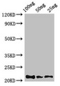 RD / PHYH Antibody - Western Blot Positive WB detected in Recombinant protein All lanes: Rubredoxin antibody at 2.8µg/ml Secondary Goat polyclonal to rabbit IgG at 1/50000 dilution predicted band size: 22 kDa observed band size: 22 kDa