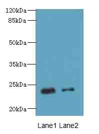 RD3 Antibody - Western blot. All lanes: RD3 antibody at 0.5 ug/ml. Lane 1: Mouse thymus tissue. Lane 2: Human placenta tissue. Secondary Goat polyclonal to Rabbit IgG at 1:10000 dilution. Predicted band size: 23 kDa. Observed band size: 23 kDa.