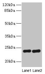 RD3 Antibody - Western blot All lanes: RD3 antibody at 0.5µg/ml Lane 1: Mouse thymus tissue Lane 2: Human placenta tissue Secondary Goat polyclonal to rabbit IgG at 1/10000 dilution Predicted band size: 23 kDa Observed band size: 23 kDa
