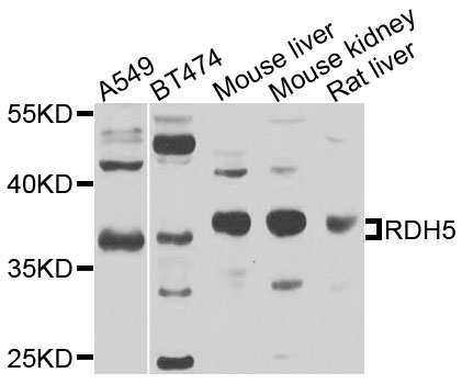 RDH1 / RDH5 Antibody - Western blot analysis of extracts of various cells.