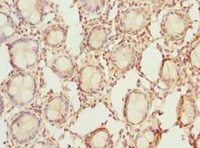 RDH1 / RDH5 Antibody - Immunohistochemistry of paraffin-embedded human rectum tissue at dilution 1:100