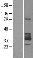 RDH1 / RDH5 Protein - Western validation with an anti-DDK antibody * L: Control HEK293 lysate R: Over-expression lysate